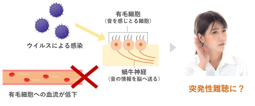 突発性難聴に？